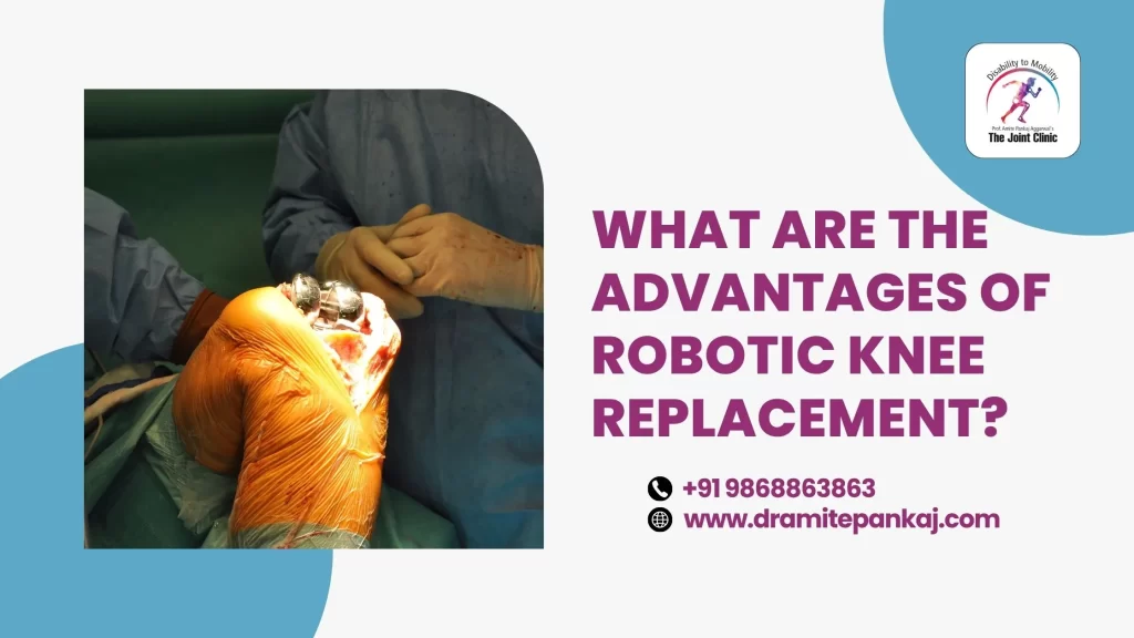 What Are the Advantages of Robotic Knee Replacement